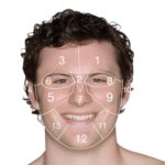 dermalogica-facial-mapping-male-extractions