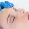 Aesthetic Treatments At Turn Beautiful Brighton Beauty Salon