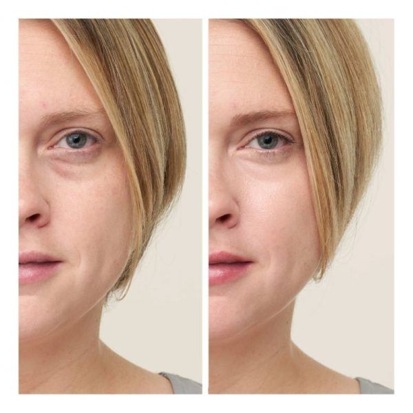 Jane Iredale Circle Delete Before And After