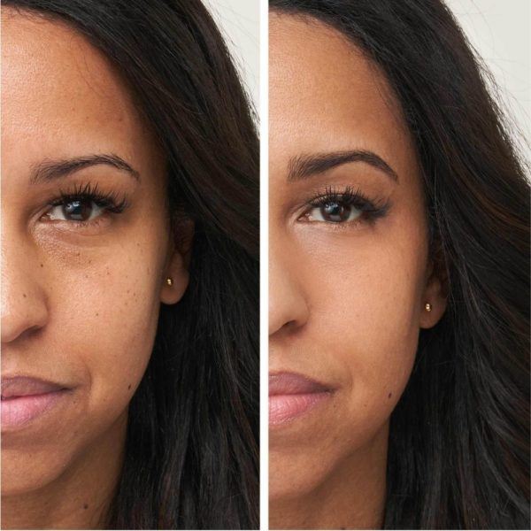 Jane Iredale Enlighten Before And After